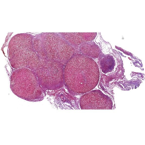 肝纖維化組織Masson染色