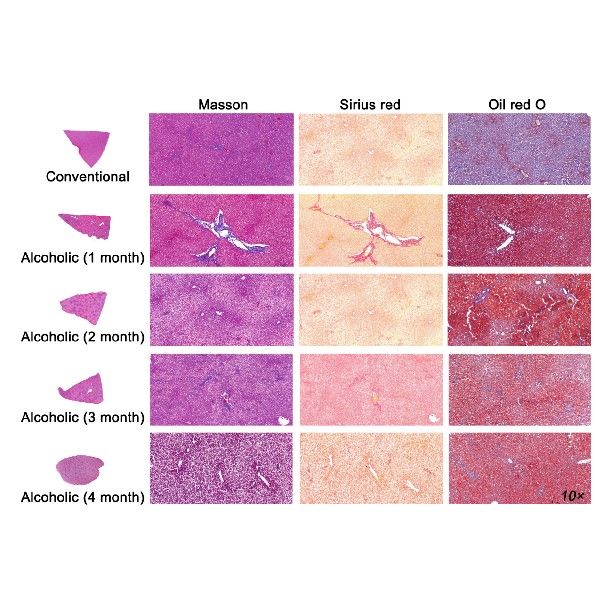 酒精性脂肪肝模型