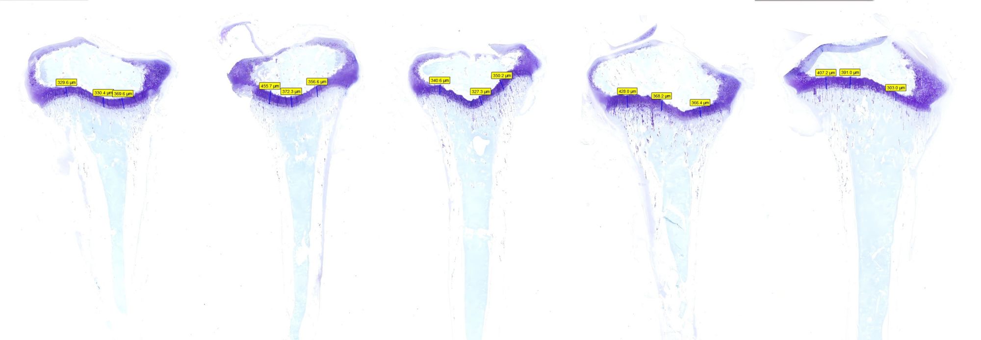 阿利新藍(lán)染色骨組織+測(cè)量