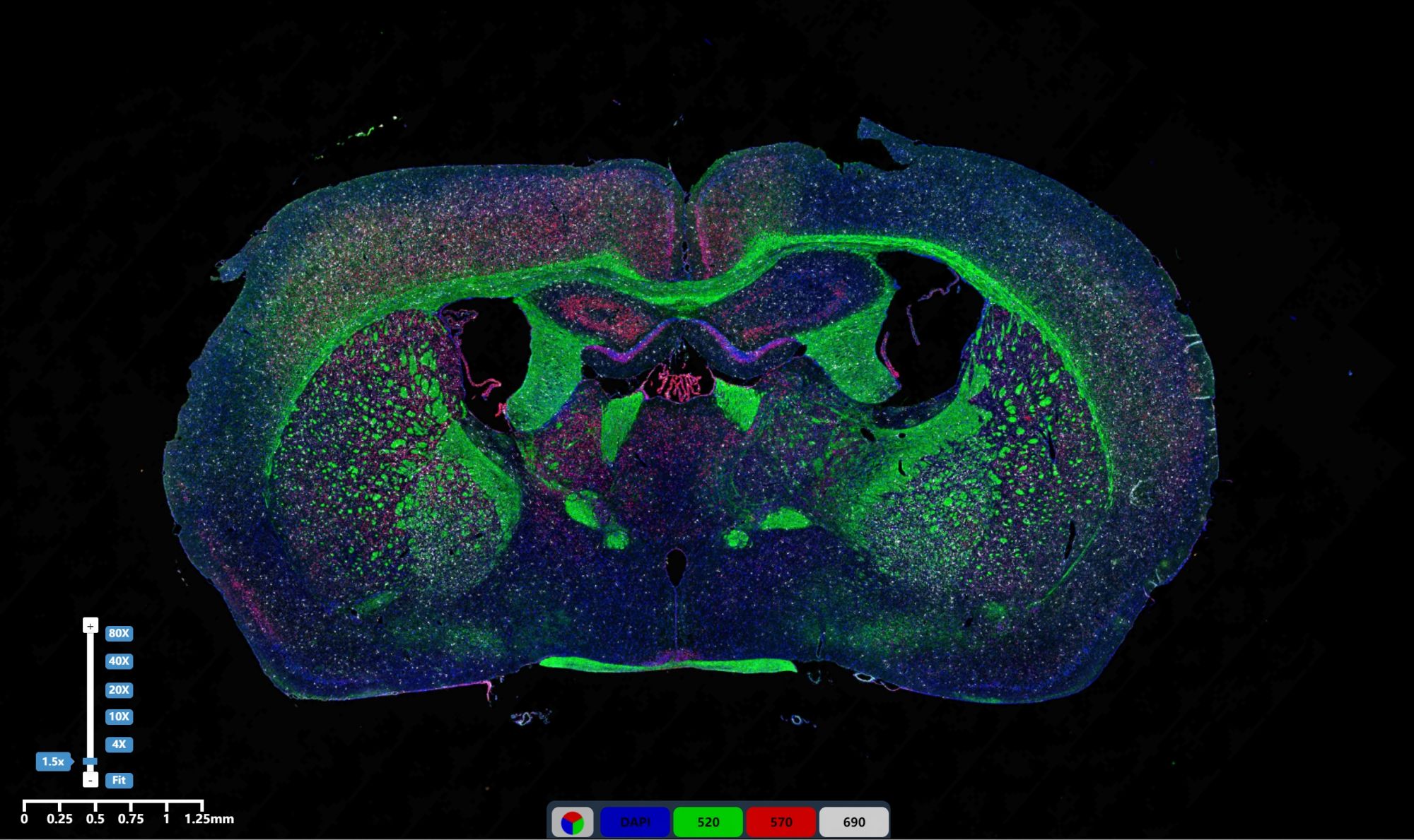 免疫熒光三標腦組織2