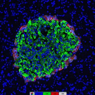 免疫熒光三標胰島組織